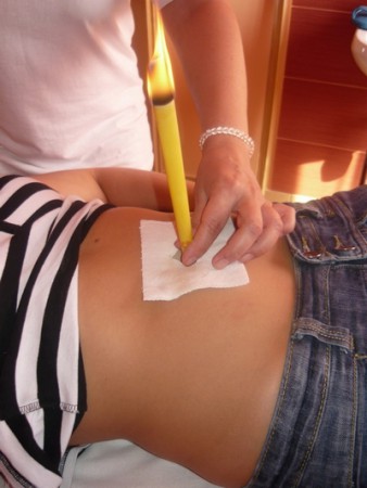 Köldök gyertyázás